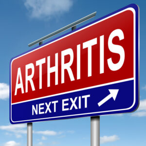 Stem cells for arthritis