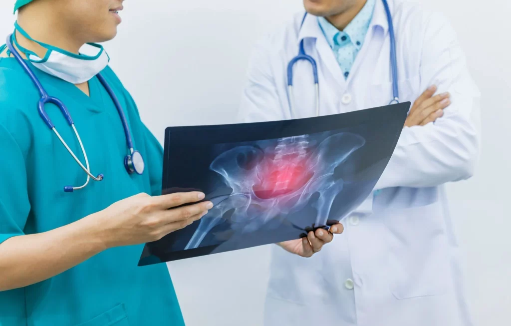 Orthopedic doctors reviewing a hip X-ray to assess arthritis risk before stem cell treatment