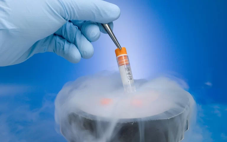 ALT: Vial of isolated adipose stem cells during lab processing after fat harvesting